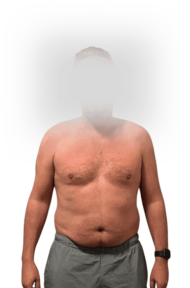 Fat Loss Transformation before