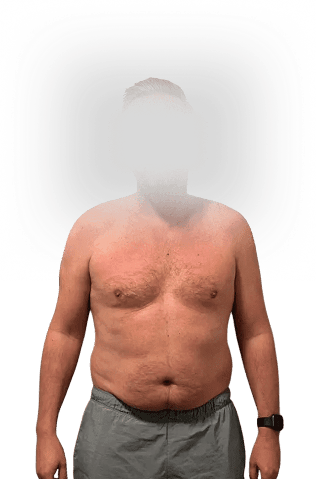 Before transformation - Body 1